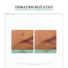 DermoPure Protective Fluid SPF 30 50 ml rezultati