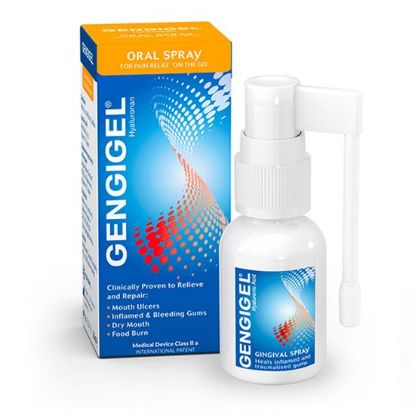 Gengigel pršilo za dlesni, 20ml