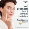 hyaluron filler elasticity 2